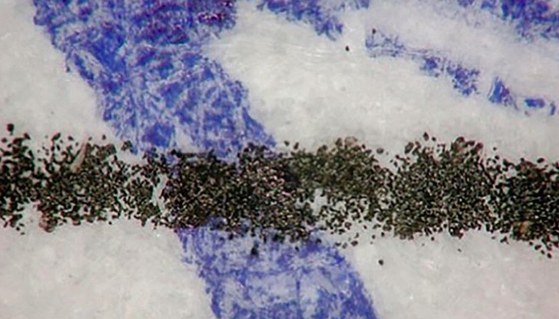 Magnified intersection between a ballpoint stroke and a toner line: the toner granules sit on top of the blue ink